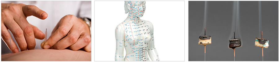 Acupuncture for Adults